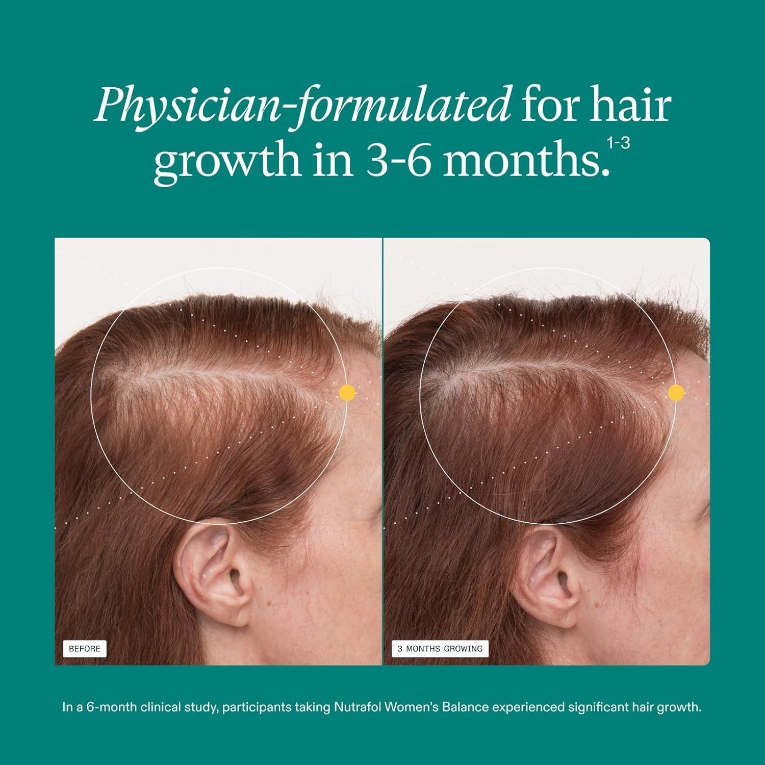 Nutrafol Women's Balance Hair Growth 120 Caps