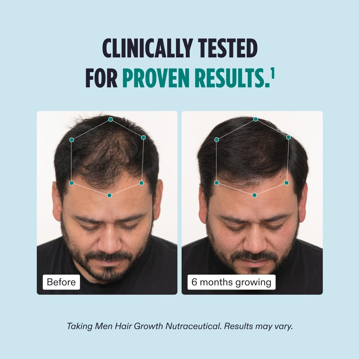 Nutrafol Men's Hair Serum, Clinically Tested to Support Visibly Thicker Hair and Scalp Coverage, Lightweight and Non-Greasy, for Daily Use - 30mL, 1 Bottle