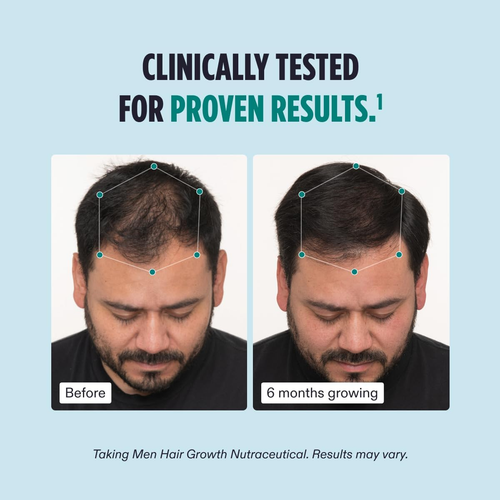 Nutrafol Men's Hair Serum, Clinically Tested to Support Visibly Thicker Hair and Scalp Coverage, Lightweight and Non-Greasy, for Daily Use - 30mL, 1 Bottle